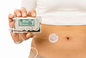 Brushless motor for insulin pump simplifies life with diabetes