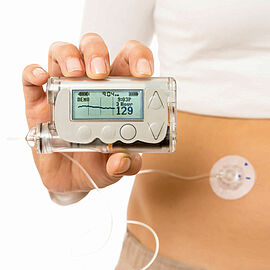 Motori brushless per la pompa dell'insulina semplifica la vita con il diabete