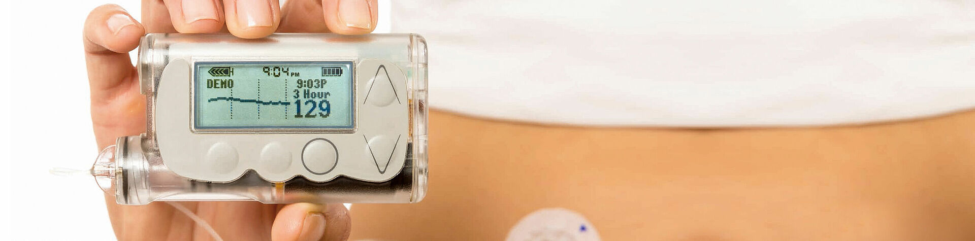 Brushless motor for insulin pump simplifies life with diabetes