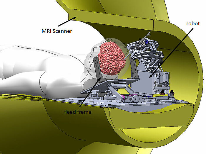 PiezoMotors puissance en MRI Robot